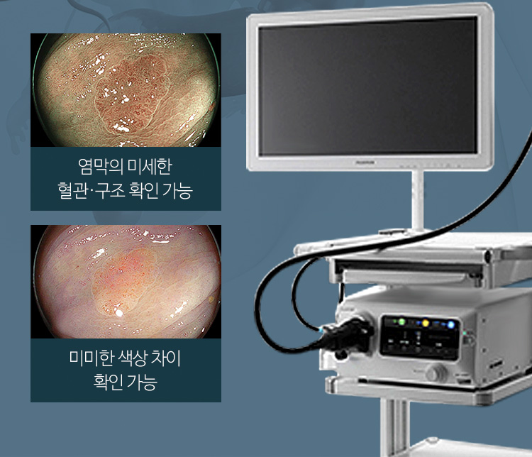 염막의 미세한 혈관·구조 확인 가능, 미미한 색상 차이 확인 가능